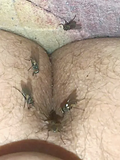 Flies on my anus in the village.  06. 2025