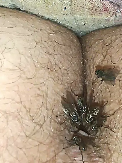 Flies on my anus in the village.  06. 2025