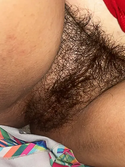 Hairy exs