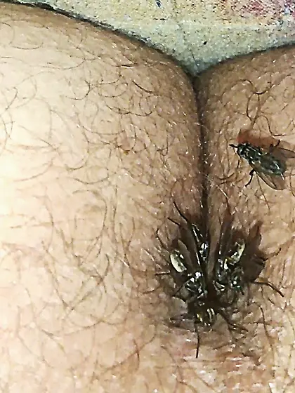 Flies on my anus in the village.  06. 2025