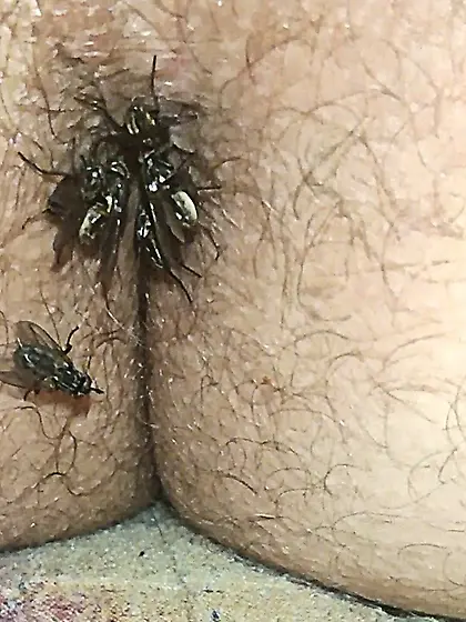 Flies on my anus in the village.  06. 2025