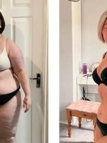 ❤️ Antes & Después ❤️