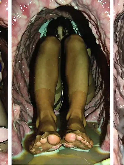 Chun-Li's Nylon Feet Being Digested 1