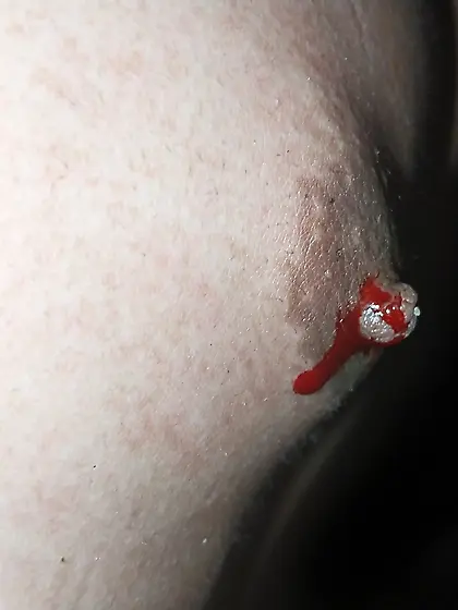 Close up bloody nipple