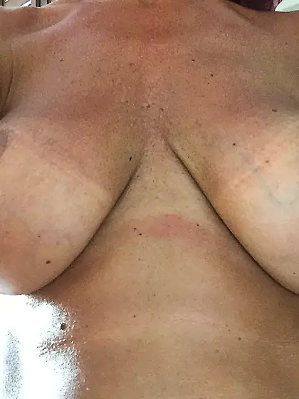 Lovely fake boobs…just before they change