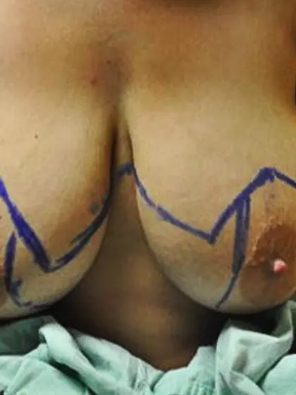 Tricia - 29yr old,  30JJ