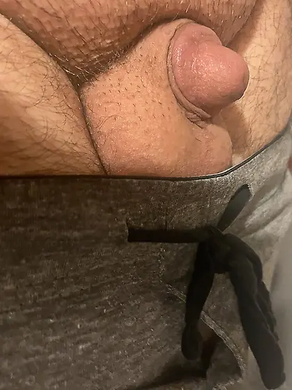 Tiny micropenis is a stub