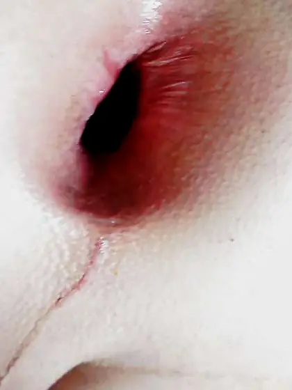 Fresh yr fresh gape, fresh knuckle, fresh stretch, fresh ass ins