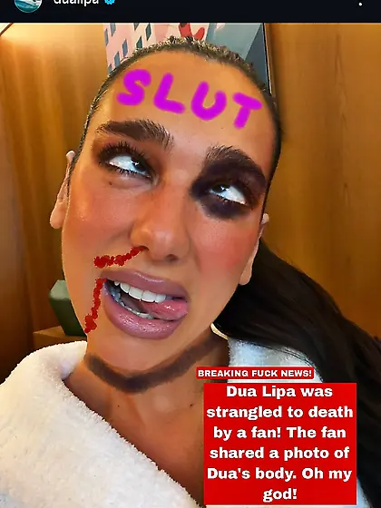 Dua Lipa Dead