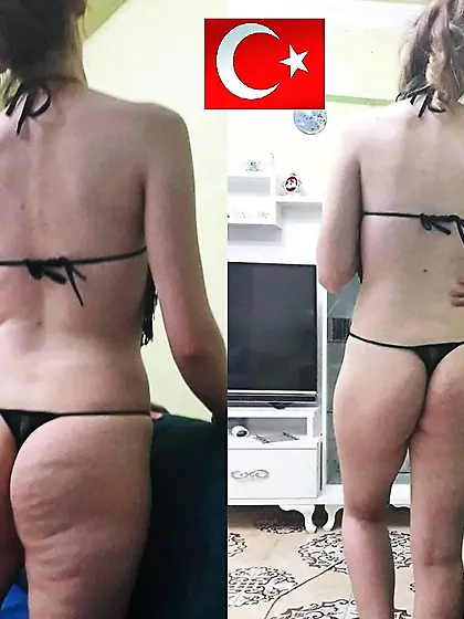 Welcome To Turkey - Amateur Turkish Gallery 02