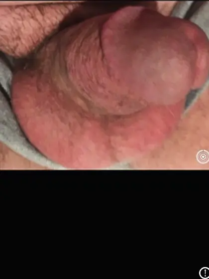 Cock and balls strangling fun