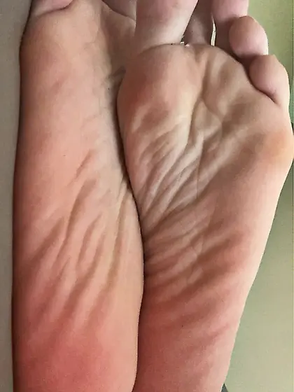 My wrinkly, soft, perfect teen soles (follow me)