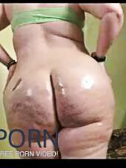 PLUMPER Cellulite Bootie