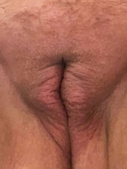 Her dad must be so proud of his stinky ginger slut