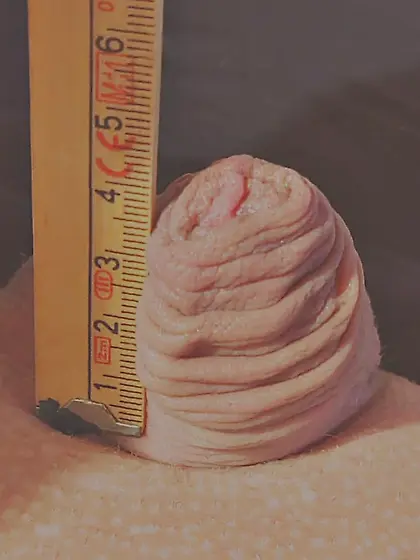 when i start with cage my Penis was 11cm soft and