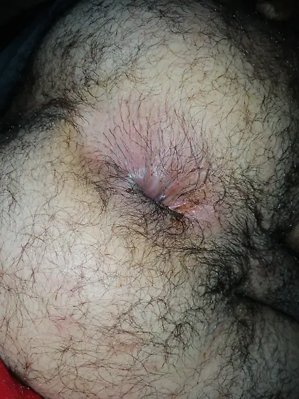 My dirty asshole