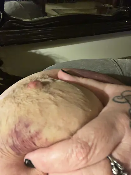 Tit zapping ⚡️⚡️⚡️