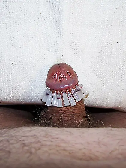 penis crown