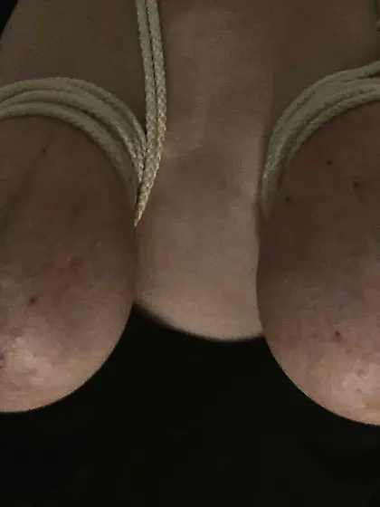 Propertys bound udders filled with 2x500 ml saline