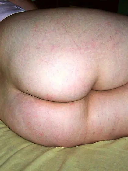 Joannes bits and pieces