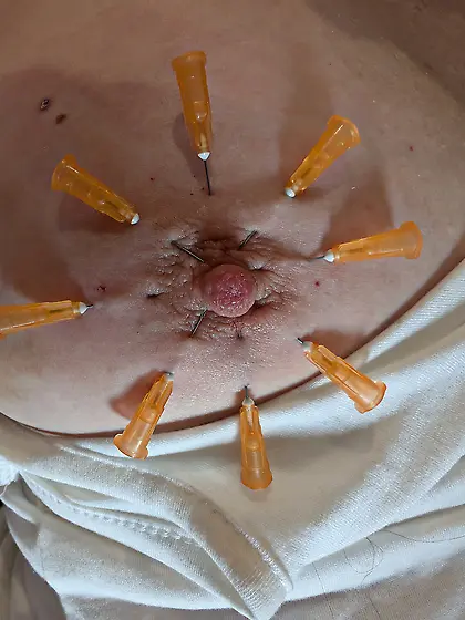 Nipple Needles 1