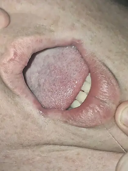 What would you put in her mouth?