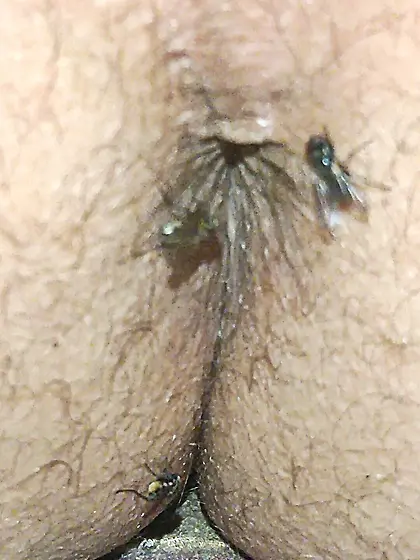 Flies on my anus in the village.  06. 2025