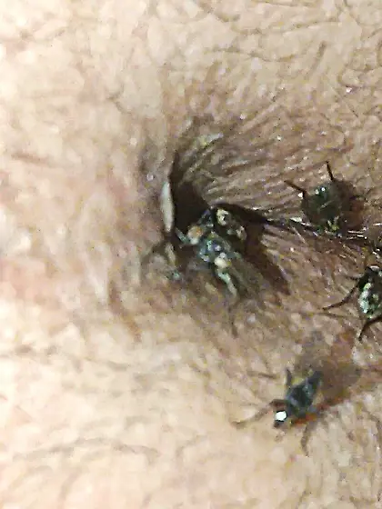 Flies on my anus in the village.  06. 2025
