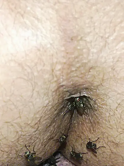 Flies on my anus in the village. 06. 2025