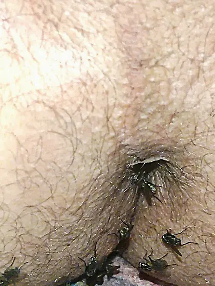 Flies on my anus in the village.  06. 2025