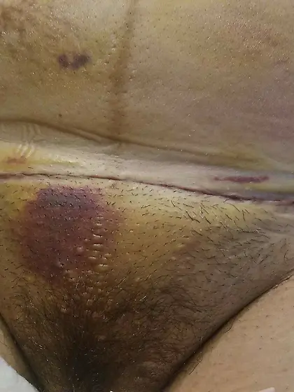 Brand new MILF showing off in the hospital