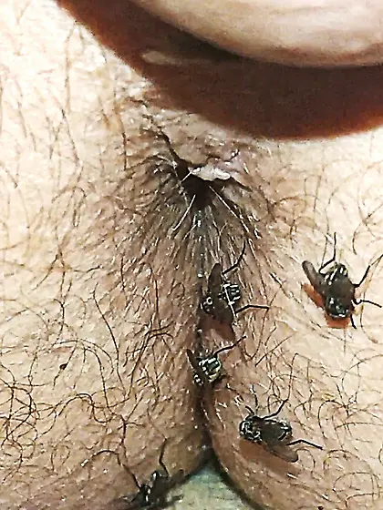Flies on my anus in the village.  06. 2025